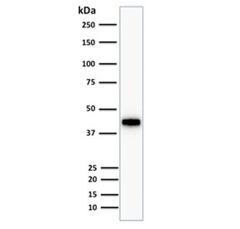 Cytokeratin 18 Antibody