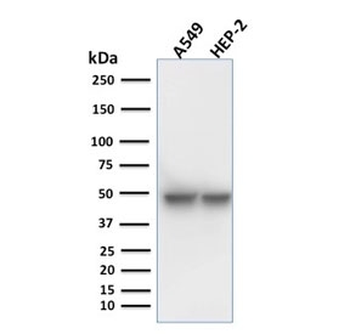 Cytokeratin 18 Antibody
