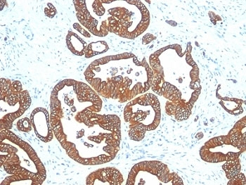 Cytokeratin 18 Antibody