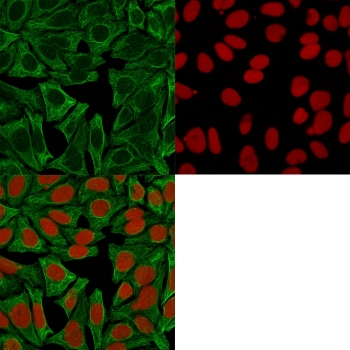 Cytokeratin 18 Antibody