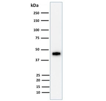 Cytokeratin 18 Antibody