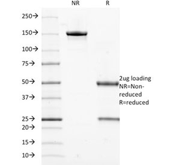 Cytokeratin 18 Antibody