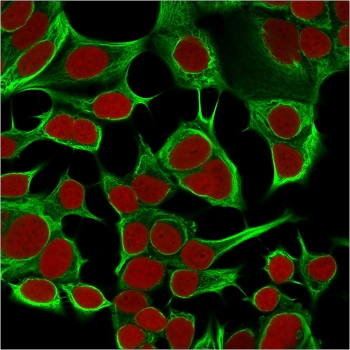 Cytokeratin 18 Antibody