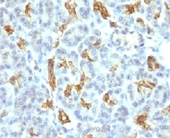KRT19 Antibody / Cytokeratin 19