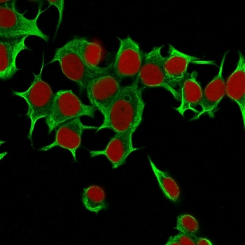 KRT19 Antibody / Cytokeratin 19