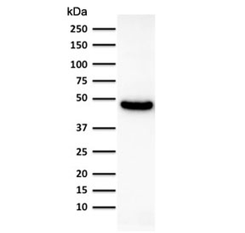 KRT19 Antibody / Cytokeratin 19