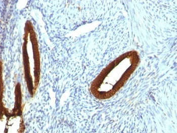KRT19 Antibody / Cytokeratin 19