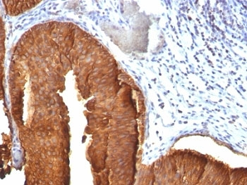 KRT19 Antibody / Cytokeratin 19