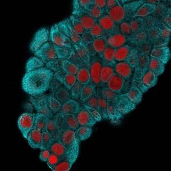 KRT19 Antibody / Cytokeratin 19