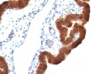 KRT19 Antibody Cocktail / Cytokeratin 19
