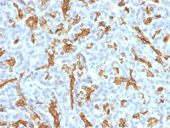 KRT19 Antibody Cocktail / Cytokeratin 19