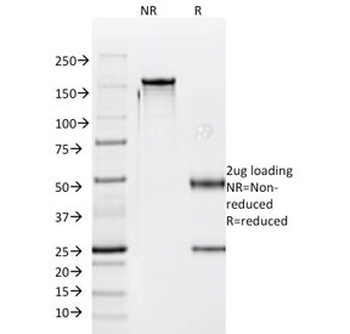 Luteinizing Hormone beta Antibody
