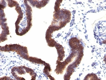 EpCAM Antibody