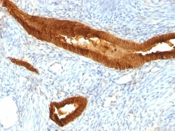 EpCAM Antibody