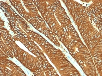 EpCAM Antibody