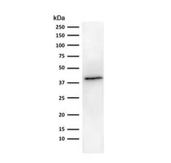 EpCAM Antibody