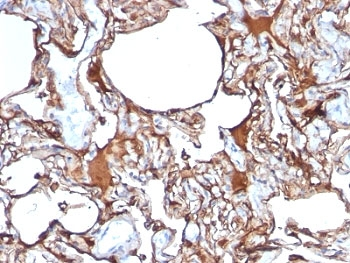CD146 Antibody / MCAM