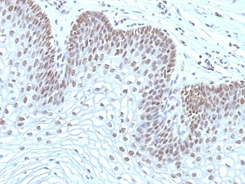 MAP3K1 Antibody (MEKK1)