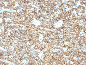 CD99 Antibody
