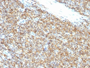CD99 Antibody