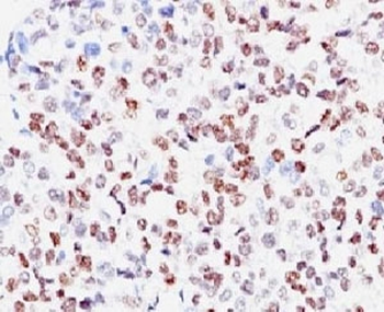 MITF Antibody