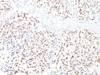 MITF Antibody Cocktail