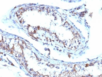 Moesin Antibody