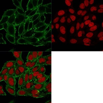 Moesin Antibody