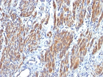SM-MHC Antibody