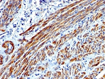 SMMHC Antibody (Smooth Muscle Myosin Heavy Chain)