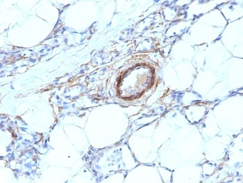 SMMHC Antibody (Smooth Muscle Myosin Heavy Chain)