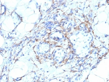 SMMHC Antibody Cocktail (Smooth Muscle Myosin Heavy Chain)