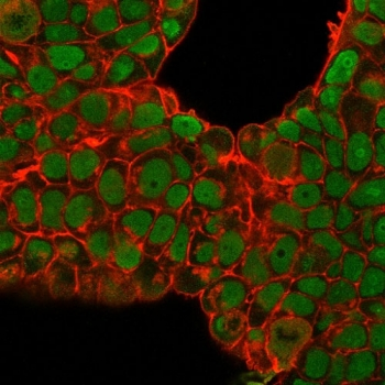 Nucleolin Antibody