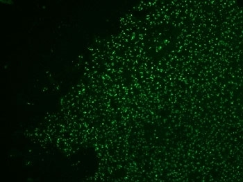 Nucleolin Antibody Cocktail
