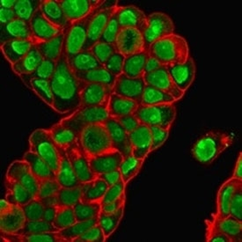 Nucleolin Antibody Cocktail
