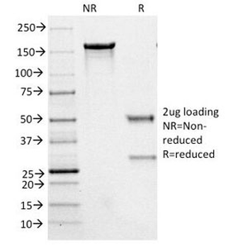 Neurofilament Antibody, phospho (NF-H)
