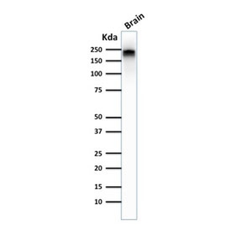 Neurofilament Antibody, phospho (NF-H)