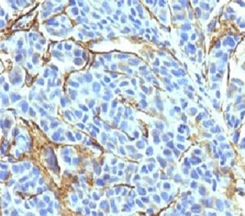 NGF Receptor Antibody / p75NTR / CD271