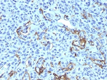 NGF Receptor Antibody Cocktail