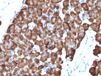 Ornithine Decarboxylase Antibody / ODC1