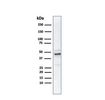 Ornithine Decarboxylase Antibody / ODC1
