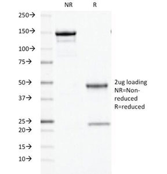 Ornithine Decarboxylase Antibody / ODC1