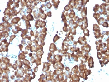 Ornithine Decarboxylase Antibody / ODC1