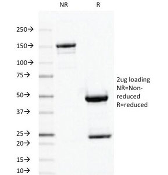 Ornithine Decarboxylase Antibody / ODC1