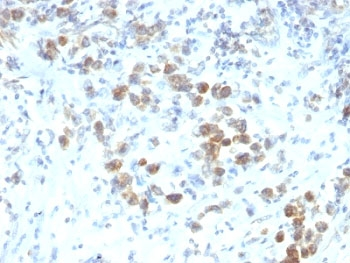PAX-6 Antibody