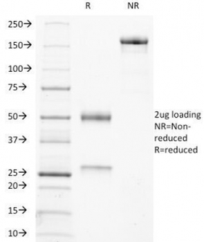 TRAcP Antibody / TRAP / ACP5