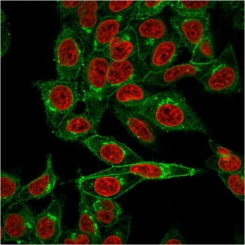 Beta-2 Microglobulin Antibody