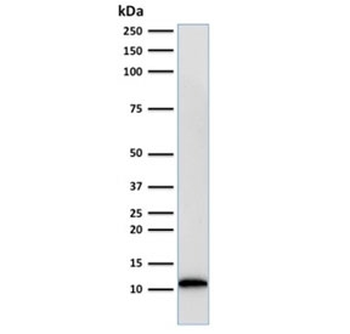 Beta-2 Microglobulin Antibody