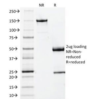 Beta-2 Microglobulin Antibody