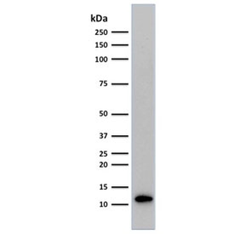 Beta-2 Microglobulin Antibody